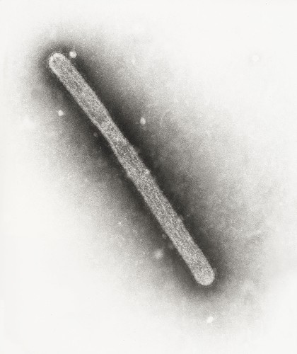 原形畢露的h5n1型禽流感病毒