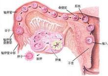 女性患有免疫性不孕的症狀有哪些