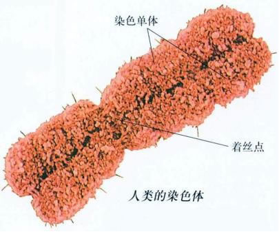 染色體病解說