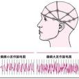 癲癇腦電圖