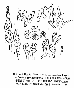 血紅鏈擔耳