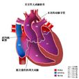 大動脈轉位