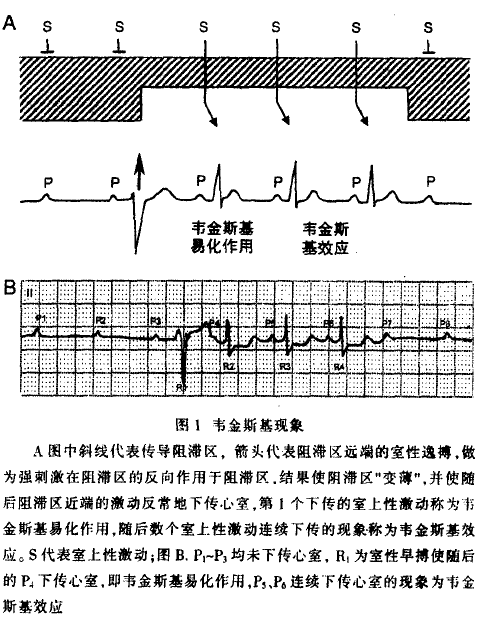 韋金斯基現象