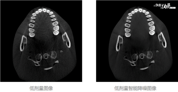 伯爵CBCT