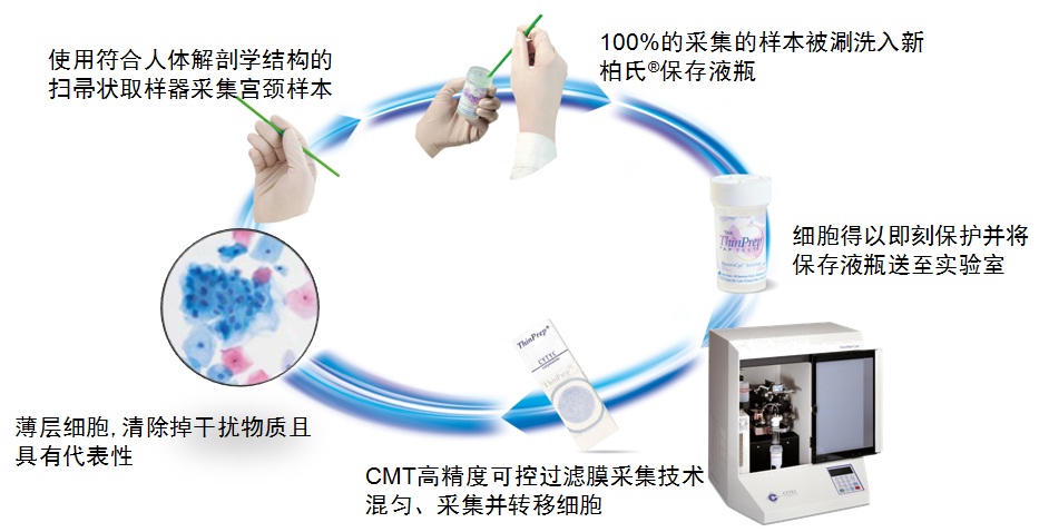 TCT檢查流程圖