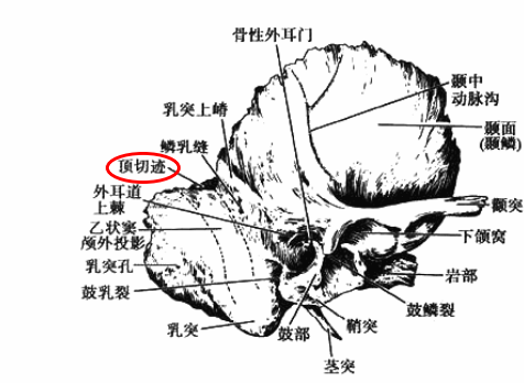 頂切跡