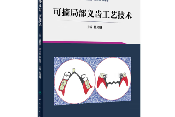 可摘局部義齒工藝技術(2019年人民衛生出版社出版的圖書)