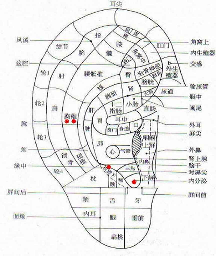 耳部治療圖