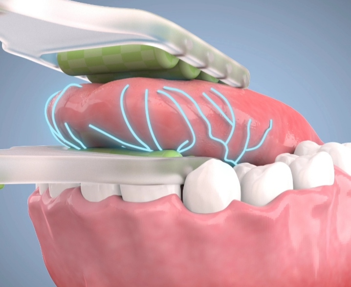 舌部按摩器
