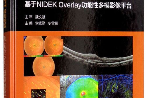 微視野+血流OCT病例圖譜：基於NIDEK OVERLAY功能性多模影像平台