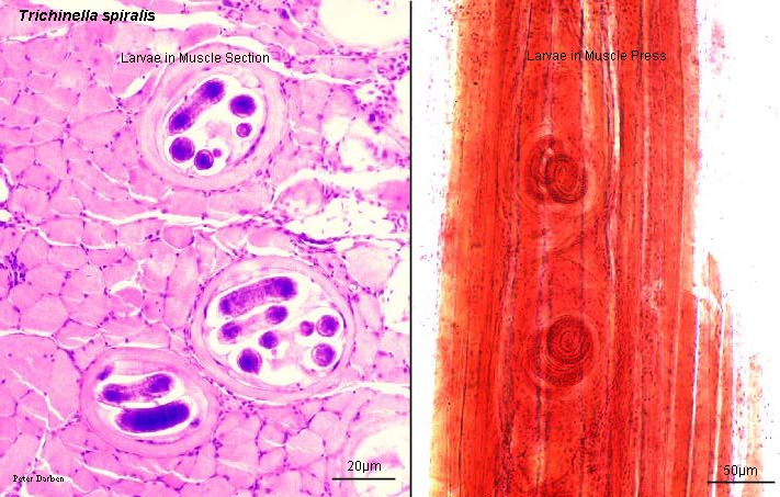 肌肉切片中囊包幼蟲