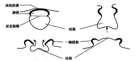 泄殖腔外翻胚胎髮生示意圖