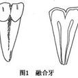 雙牙畸形