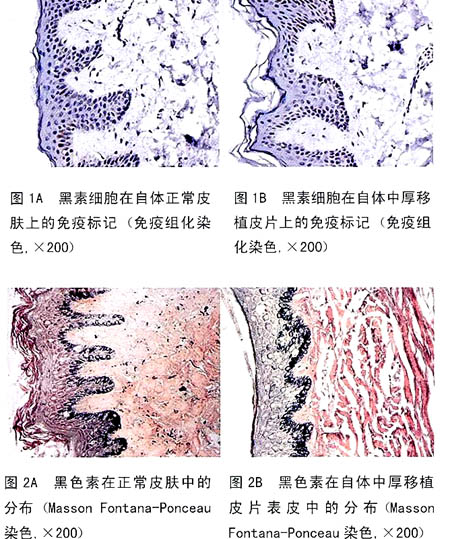 促黑素細胞激素(促黑激素)