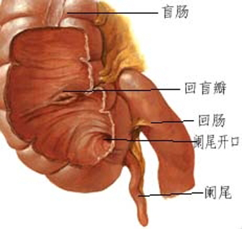 妊娠合併闌尾炎