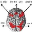 胼胝體變性