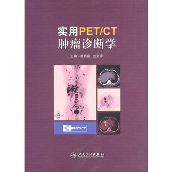 實用PET/CT腫瘤診斷學