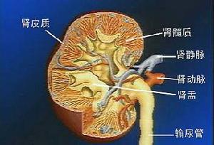 系統性紅斑狼瘡性腎炎