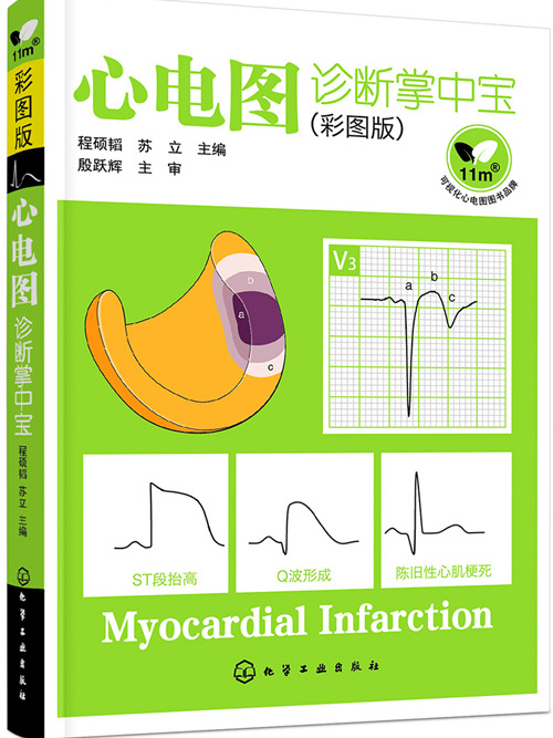 心電圖診斷掌中寶（彩圖版）