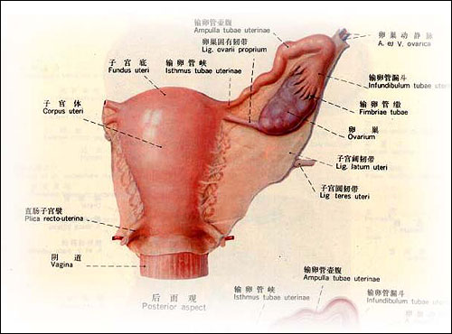 雙側多囊卵巢