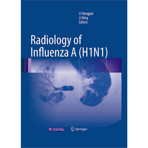 Radiology of influenza A(H1N1) （甲型H1N1流感影像學）