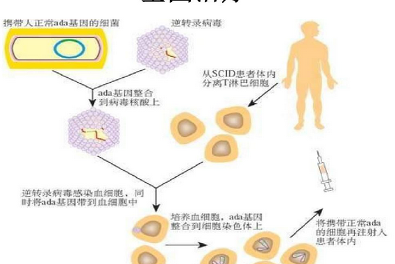 基因療法