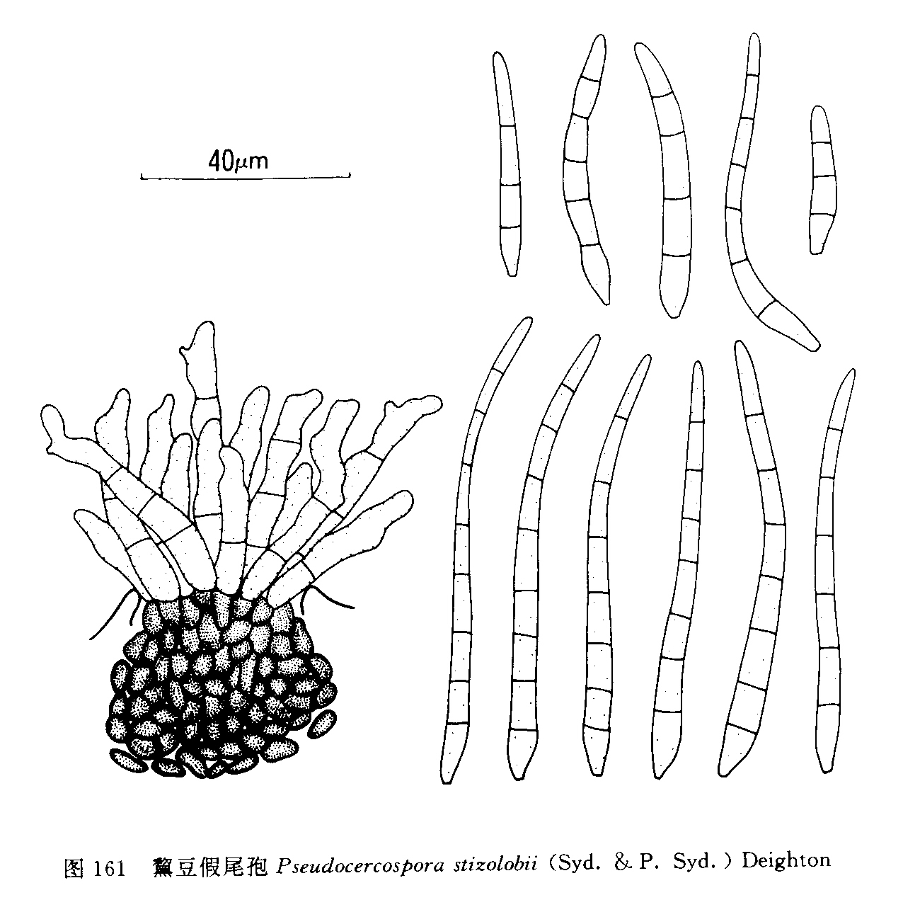 黧豆假尾孢