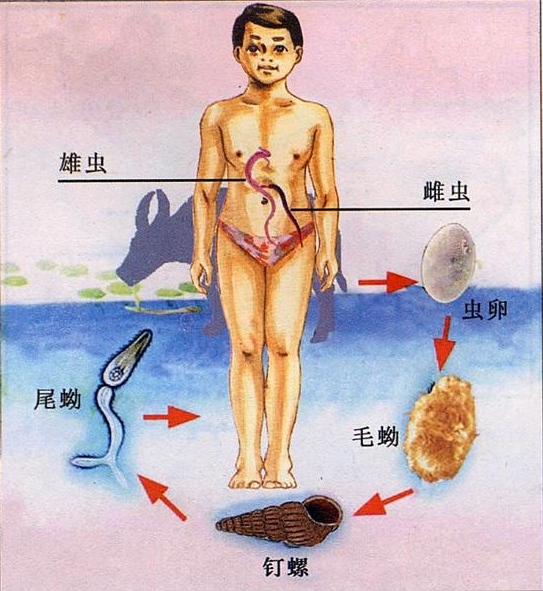 打擺子