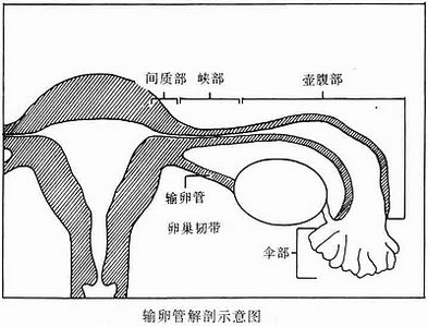 輸卵管堵塞