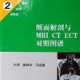 斷面解剖與MRI CT ECT對照圖譜(2)-腹部盆部四肢部