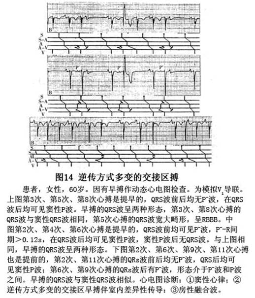 隱匿性傳導