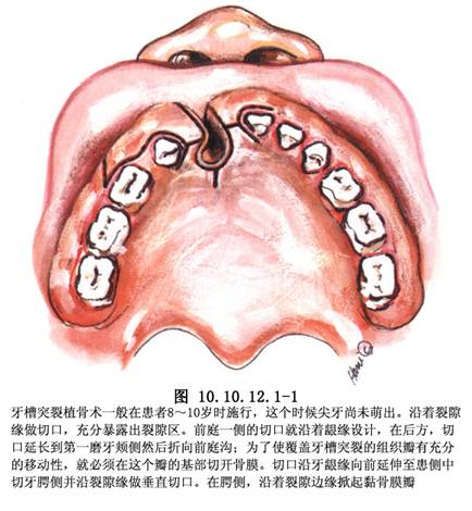 牙槽突