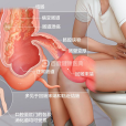 克羅恩病(cd（克羅恩病(Crohn’s disease,CD)）)