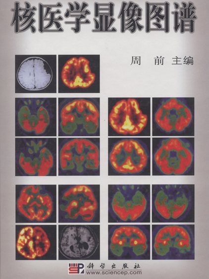 核醫學顯像圖譜