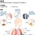 鉻酸鹽製造業工人肺癌