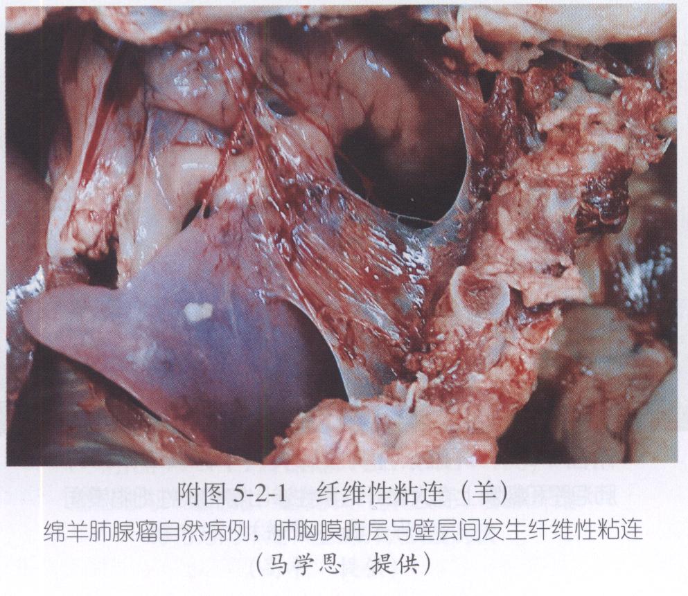 肌肉粘連