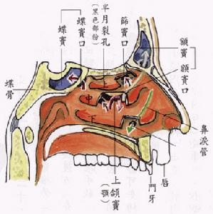 乙硫異煙胺(Ethionamide)