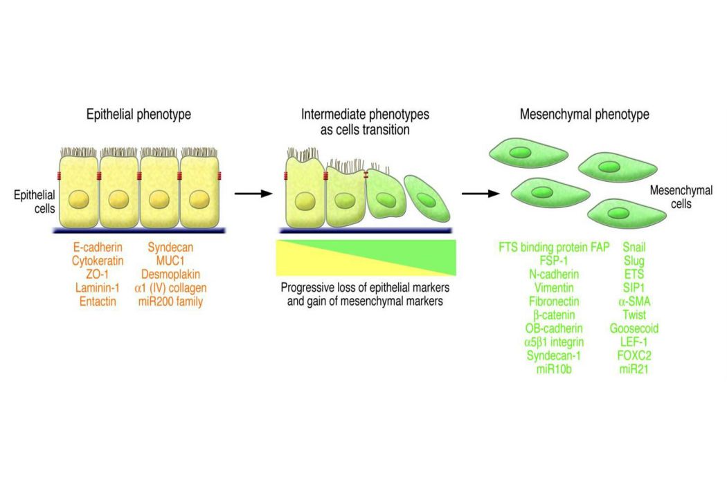 上皮細胞-間充質轉化