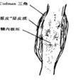 Codman三角