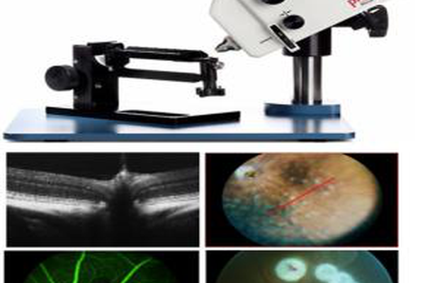 小動物視網膜顯微成像系統