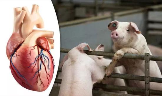 豬心臟移植試驗