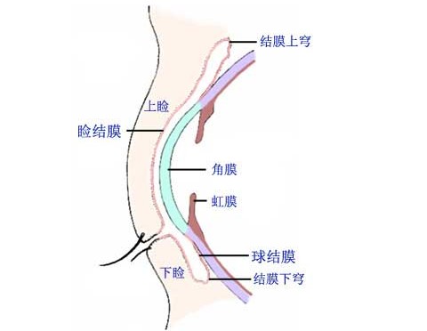 眼瞼裂斑