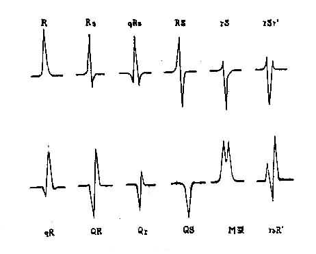 正常心電圖