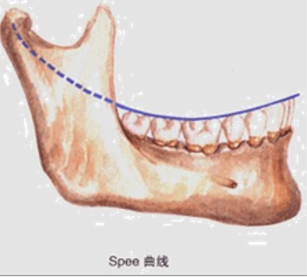 司匹曲線(spee曲線)