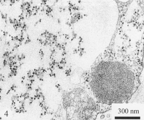 玉米雷亞朵非納病毒粒子現於細胞質和液泡中