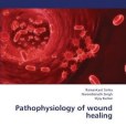 Pathophysiology of Wound Healing