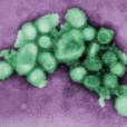 甲型H1N1流感病毒(甲型H1N1流感診療方案（2009年試行版第二版）)