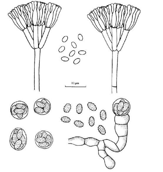 沃特曼籃狀菌