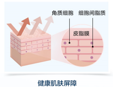 乾敏肌