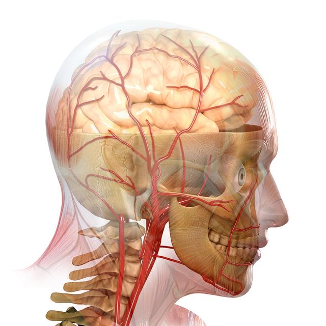 狼瘡性腦病